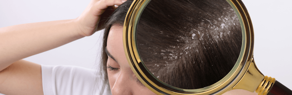 Shampoo anticaspa Nuggela & Sulé
