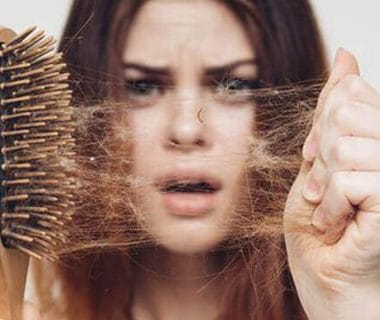 Tipos de alopecia