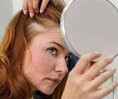Tipos de alopecia