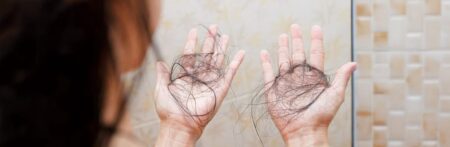 Perdida de cabello