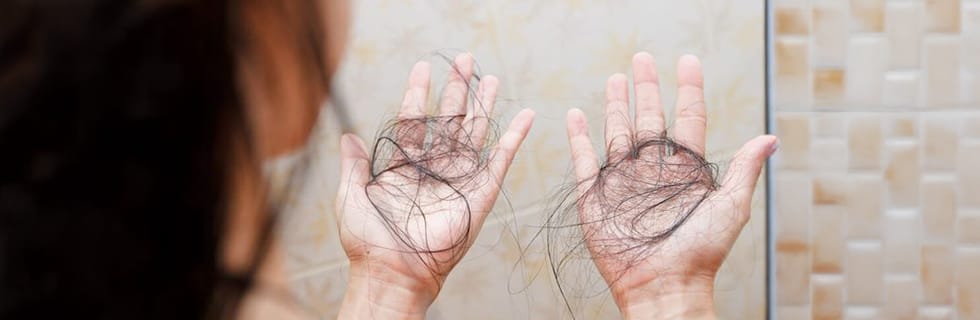 Perdida de cabello