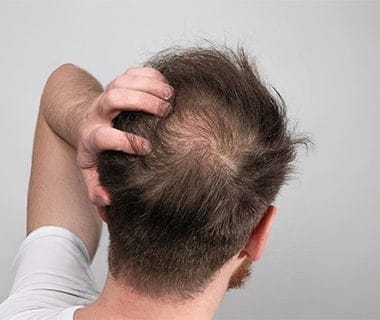 Tips para detener la caída del cabello
