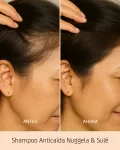 Shampoo Anticaída Anti-Caspa