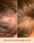 Shampoo Anticaída Anti-Caspa